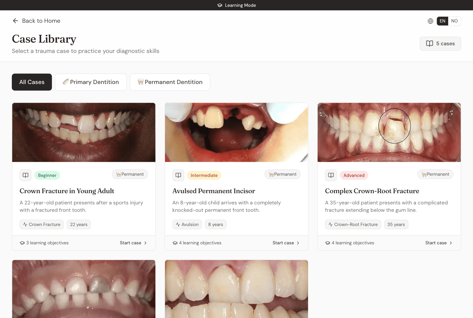 The case library, filterable by primary and permanent dentition.