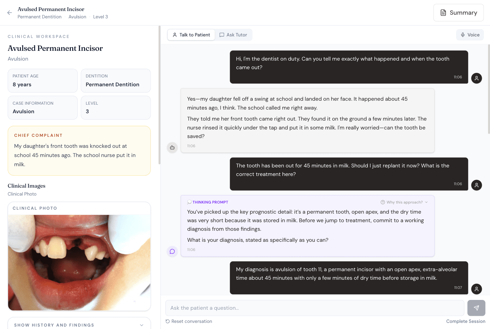 The Si-DentAI clinical workspace: case record and clinical photograph on the left, the conversation with the patient and tutor on the right.